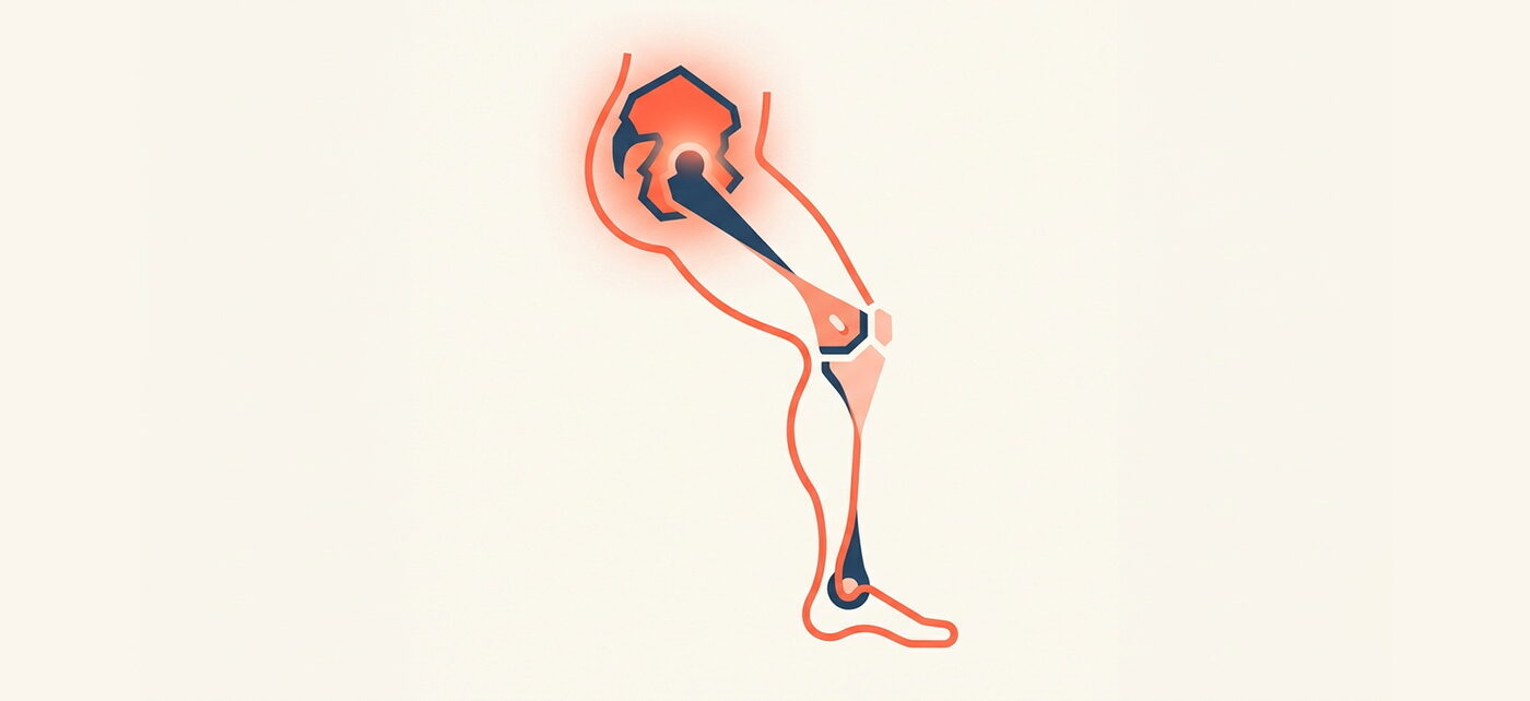 An illustration of a leg drawn as a linked chain of hip, knee and ankle, with the hip glowing to show the real source of knee pain